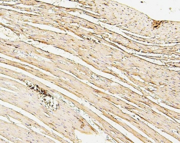 IHC staining of FFPE rat heart with SDHB antibody. HIER: boil tissue sections in pH6, 10mM citrate buffer, for 20 min and allow to cool before testing.