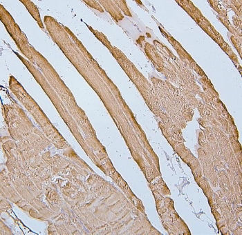 Desmin Antibody Human Skeletal Muscle IHC. Immunohistochemistry staining of FFPE human skeletal muscle with Desmin antibody. HIER: boil tissue sections in pH6, 10mM citrate buffer, for 20 min and allow to cool before testing.