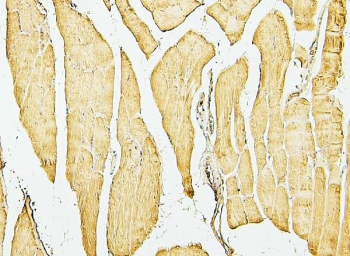 Desmin Antibody Mouse Muscle Immunohistochemistry. IHC analysis of FFPE mouse skeletal muscle with Desmin antibody. HIER: boil tissue sections in pH6, 10mM citrate buffer, for 20 min and allow to cool before testing.