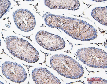 IHC staining of FFPE rat testis with COMT antibody. HIER: boil tissue sections in pH6, 10mM citrate buffer, for 20 min and allow to cool before testing.