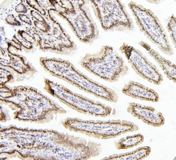 IHC staining of FFPE mouse intestine with PTBP1 antibody. HIER: boil tissue sections in pH6, 10mM citrate buffer, for 20 min and allow to cool before testing.