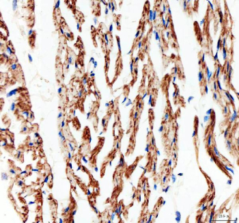 Immunohistochemical staining of FFPE mouse heart tissue with Connexin 43 antibody, HRP-secondary and DAB substrate. HIER: boil tissue sections in pH8 EDTA for 20 min and allow to cool before testing.