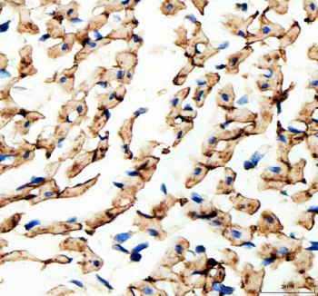 Immunohistochemical staining of FFPE rat heart tissue with Connexin 43 antibody, HRP-secondary and DAB substrate. HIER: boil tissue sections in pH8 EDTA for 20 min and allow to cool before testing.