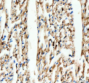 Immunohistochemical staining of FFPE rat heart tissue with Connexin 43 antibody, HRP-secondary and DAB substrate. HIER: boil tissue sections in pH8 EDTA for 20 min and allow to cool before testing.