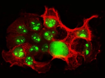 Nucleolin Antibody Rabbit Polyclonal immunofluorescence analysis of human A431 cells. Formalin-fixed cells stained with Nucleolin Antibody Rabbit Polyclonal (green) and Beta Tubulin antibody (red). Green fluorescence highlights nucleolin-positive nuclei and nucleoli, consistent with the expected nuclear and nucleolar localization of Nucleolin / NCL, while Beta Tubulin staining outlines the cytoskeletal network within the cytoplasm.