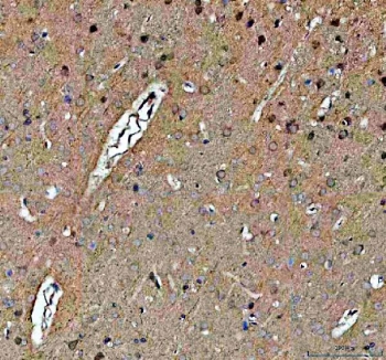 IHC staining of FFPE rat brain tissue with NOTCH2 antibody. HIER: boil tissue sections in pH8 EDTA for 20 min and allow to cool before testing.