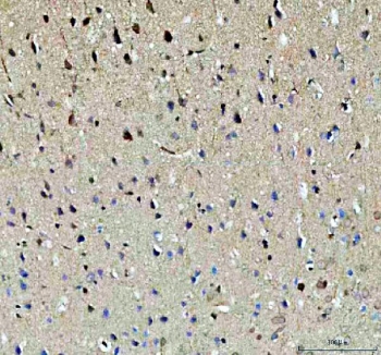 IHC staining of FFPE rat brain tissue with NOTCH2 antibody. HIER: boil tissue sections in pH8 EDTA for 20 min and allow to cool before testing.