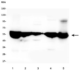 ALDH2 Antibody Rodent Tissue Panel WB. Western blot analysis of ALDH2 expression was performed using anti-ALDH2 antibody in rat and mouse tissue lysates. Lane 1: rat liver lysate. Lane 2: rat kidney lysate. Lane 3: rat heart lysate. Lane 4: mouse liver lysate. Lane 5: mouse kidney lysate. ALDH2, also known as Aldehyde Dehydrogenase 2, is a mitochondrial enzyme responsible for the oxidation and detoxification of reactive aldehydes generated during alcohol metabolism, lipid peroxidation, and oxidative stress. A prominent immunoreactive band is detected at approximately 56 kDa in all samples, corresponding to the predicted molecular weight of ALDH2. Strong expression across liver, kidney, and heart tissues is consistent with the essential role of ALDH2 in mitochondrial detoxification and metabolic homeostasis within highly active organs. These results support the utility of ALDH2 Antibody for studies of aldehyde metabolism, mitochondrial function, oxidative stress responses, and tissue protection mechanisms.