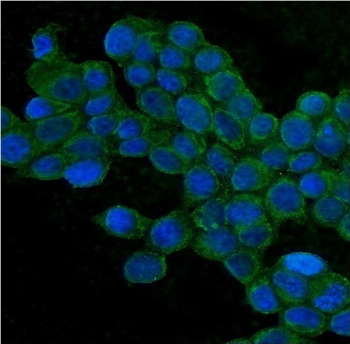 Immunofluorescent staining of FFPE human MCF7 cells with TJP1 antibody (green) and DAPI nuclear stain (blue).