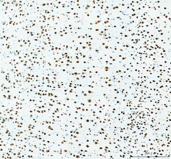 IHC staining of FFPE rat brain cortex tissue with Fox2 antibody. HIER: boil tissue sections in pH8 EDTA for 20 min and allow to cool before testing.