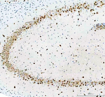 IHC staining of FFPE rat hippocampus tissue with Fox2 antibody. HIER: boil tissue sections in pH8 EDTA for 20 min and allow to cool before testing.