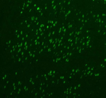 Immunofluorescent staining of FFPE rat brain tissue with Fox2 antibody (green). HIER: steam section in pH8 EDTA buffer for 20 min.