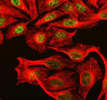 Immunofluorescent staining of FFPE human U-2 OS cells with Fox antibody (green) and Alpha Tubulin mAb (red). HIER: steam section in pH6 citrate buffer for 20 min.