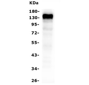 CD22 Antibody for WB. Western blot analysis of CD22/Siglec-2 expression using CD22 Western Blot Antibody clone 5E7 in human Raji cell lysate. A band is detected at approximately 130-150 kDa, consistent with the predicted molecular weight of CD22 / CD22 and reflecting its glycosylated form, while potential lower molecular weight species may represent less glycosylated variants of the protein. This banding pattern aligns with the known expression of CD22 in B cell lymphoma-derived cells and supports its use for western blot analysis of B cell-associated protein expression.