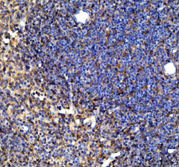 IHC staining of FFPE mouse spleen tissue with SYK antibody, HRP-secondary and DAB substrate. HIER: boil tissue sections in pH8 EDTA for 20 min and allow to cool before testing.