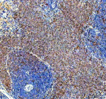 IHC staining of FFPE rat spleen tissue with SYK antibody, HRP-secondary and DAB substrate. HIER: boil tissue sections in pH8 EDTA for 20 min and allow to cool before testing.