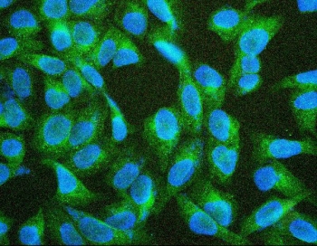 Immunofluorescence analysis of TIE2 / TEK tyrosine kinase antibody in human U-2 OS cells. FFPE human U-2 OS sections show cytoplasmic and membranous green fluorescence consistent with TIE2 expression, while nuclei are counterstained with DAPI (blue). Signal appears distributed throughout the cytoplasm with peripheral accentuation suggestive of membrane-associated localization. Heat induced epitope retrieval was performed in 10 mM citrate buffer, pH 6.0, by boiling for 20 minutes followed by cooling prior to antibody incubation.