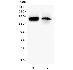 Western blot testing of mouse 1) lung and 2) Neuro-2a lysate with TIE2 antibody. Predicted molecular weight: ~126 kDa but may be observable at 130-165 kDa.