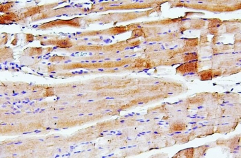 IHC staining of FFPE rat skeletal muscle with TNNI2 antibody. HIER: boil tissue sections in pH6, 10mM citrate buffer, for 20 min and allow to cool before testing.