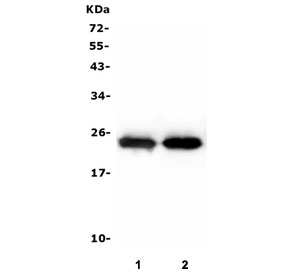 Western blot testing of 1) rat skeletal muscle and 2) mouse skeletal muscle lysate with TNNI2 antibody. Predicted molecular weight: ~21 kDa.