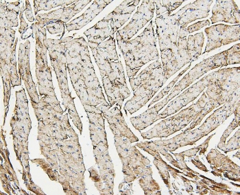 IHC staining of FFPE mouse heart with Aldolase A antibody. HIER: boil tissue sections in pH6, 10mM citrate buffer, for 20 min and allow to cool before testing.