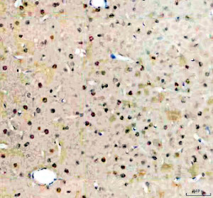 BMAL1 Antibody Rat Brain IHC. Immunohistochemical analysis of BMAL1 Antibody / Circadian Clock Protein Antibody in FFPE rat brain tissue following heat-induced antigen retrieval in pH 8 EDTA buffer. The section was incubated with BMAL1 antibody at 2 ug/ml and detected using an HRP-conjugated secondary antibody with DAB chromogen. Positive nuclear staining is observed in brain cells, consistent with the transcription factor activity of BMAL1. This BMAL1 Antibody, a circadian clock protein antibody, is suitable for investigating circadian rhythm regulation, transcriptional control and central nervous system biology.