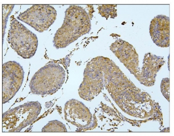 IHC staining of FFPE rat testis tissue with BubR1 antibody. HIER: boil tissue sections in pH8 EDTA buffer for 20 min and allow to cool before testing.