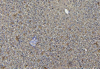 IHC staining of FFPE rat liver with Aldolase B antibody. HIER: boil tissue sections in pH6, 10mM citrate buffer, for 20 min and allow to cool before testing.