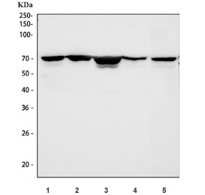 Western blot testing of 1) human A431, 2) human SH-SY5Y, 3) human 293T, 4) rat brain and 5) mouse brain tissue lysate with DDX5 antibody. Predicted molecular weight: ~68 kDa.