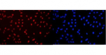 Immunofluorescent staining of FFPE human U-2 OS cells with DDX5 antibody (red) and DAPI nuclear stain (blue). HIER: boil tissue sections in pH6, 10mM citrate buffer, for 20 min and allow to cool before testing.
