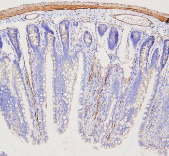IHC staining of FFPE rat intestine with Filamin A antibody. HIER: boil tissue sections in pH6, 10mM citrate buffer, for 20 min and allow to cool before testing.