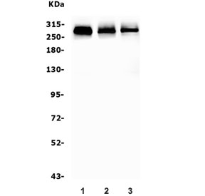 Western blot testing of 1) rat ovary, 2) mouse lung and 3) mouse HEPA1-6 lysate with Filamin A antibody. Predicted molecular weight ~281 kDa.