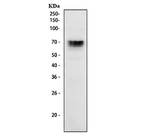 FOXC1 Antibody 293T Cell WB. Western blot analysis of human 293T cell lysate using FOXC1 Antibody / Forkhead Transcription Factor Antibody demonstrates a distinct immunoreactive band at approximately 70-75 kDa, consistent with expression of FOXC1. Although the predicted molecular weight of FOXC1 is approximately 57 kDa, the protein is frequently observed at higher apparent molecular weights due to post-translational modifications that affect electrophoretic mobility. FOXC1 is a forkhead box transcription factor that regulates gene expression programs involved in embryonic development, tissue patterning, cellular differentiation, stem cell maintenance, and organogenesis. The observed banding pattern is consistent with endogenous FOXC1 expression in human 293T cells. Predicted molecular weight: approximately 57 kDa. Commonly observed molecular weight: up to 75 kDa.