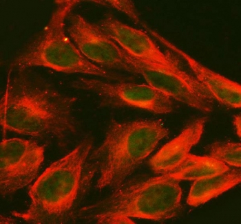 FOXC1 Antibody IF. Immunofluorescent staining of FFPE human HeLa cells using FOXC1 Antibody / Forkhead Transcription Factor Antibody demonstrates green fluorescence localized predominantly within cell nuclei, consistent with the expected localization of FOXC1 as a DNA-binding transcription factor. FOXC1 regulates gene expression programs involved in embryonic development, cellular differentiation, tissue patterning, and stem cell-associated signaling pathways. Co-staining with Alpha Tubulin monoclonal antibody (red) highlights the cytoskeletal network and provides cellular context for nuclear FOXC1 expression. HIER was performed by steaming sections in pH 6 citrate buffer for 20 minutes prior to immunofluorescent staining. Green = FOXC1 antibody; Red = Alpha Tubulin monoclonal antibody; nuclei appear green due to nuclear FOXC1 localization.