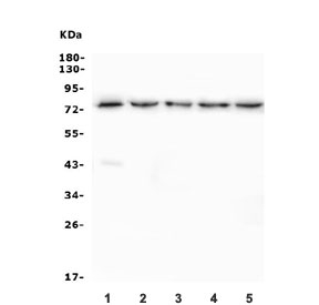 Western blot testing of 1) rat liver, 2) human ThP-1, 3) human Raji, 4) human U-87 MG and 5) mouse RAW246.7 lysate with CETP antibody. Expected molecular weight: 66-74 kDa depending on glycosylation level.