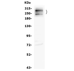 CD35 Antibody HL60 WB. Western blot testing of human HL-60 cell lysate with CD35 antibody. Expected molecular weight: 220-300 kDa.