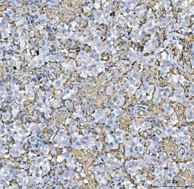 IHC staining of FFPE human seminoma testis tissue with HLA-DRA antibody. HIER: boil tissue sections in pH6, 10mM citrate buffer, for 20 min and allow to cool before testing.
