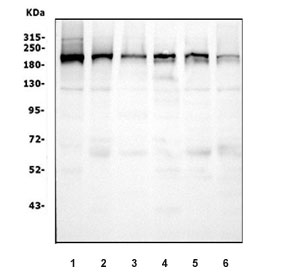 Western blot testing of human 1) U-87 MG, 2) SW620, 3) U-2 OS, 4) HEK293, 5) K562 and 6) HepG2 cell lysate with IQGAP1 antibody. Predicted molecular weight ~189 kDa.