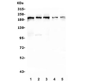 Western blot testing of human 1) U-87 MG, 2) HL-60, 3) HeLa, 4) U-2 OS and 5) Caco-2 lysate with IQGAP1 antibody. Predicted molecular weight ~189 kDa.