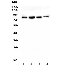 Western blot testing of 1) rat brain, 2) rat liver, 3) mouse brain and 4) mouse Neuro-2a lysate with IRAK1 antibody. Predicted molecular weight 68-76 kDa.