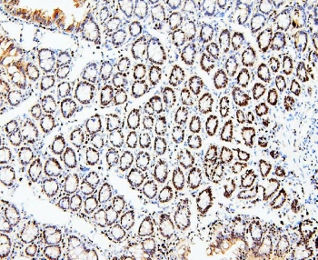 IHC staining of FFPE rat intestinal tissue with MCM2 antibody. HIER: boil tissue sections in pH6, 10mM citrate buffer, for 20 min and allow to cool before testing.