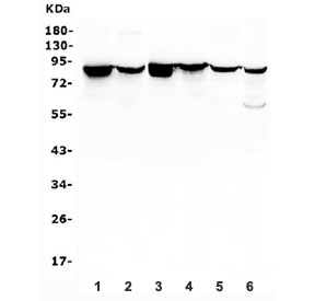 Western blot testing of 1) rat liver, 2) rat brain, 3) mouse lung, 4) mouse liver, 5) mouse brain and 6) mouse Neuro-2a lysate with Radixin antibody. Predicted molecular weight: ~69 kDa, routinely observed at ~82 kDa.