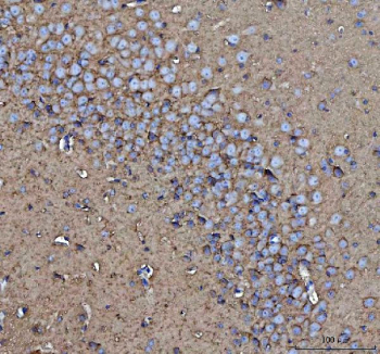 Immunohistochemical staining of FFPE mouse brain tissue with CD90 antibody, HRP-secondary and DAB substrate. HIER: boil tissue sections in pH8 EDTA for 20 min and allow to cool before testing.