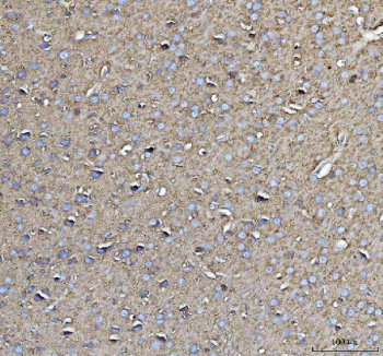 Immunohistochemical staining of FFPE rat brain tissue with CD90 antibody, HRP-secondary and DAB substrate. HIER: boil tissue sections in pH8 EDTA for 20 min and allow to cool before testing.