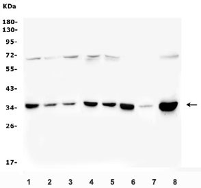 Western blot analysis of PITX2 using PITX2 antibody. PITX2 expression was examined in human Caco-2 (lane 1), HEK293 (lane 2), U2OS (lane 3), HeLa (lane 4), A549 (lane 5), and U-87MG (lane 6) whole cell lysates, as well as rat heart tissue lysates (lane 7) and mouse RAW264.7 whole cell lysates (lane 8). A predominant band is detected at approximately 35 kDa, consistent with the predicted molecular weight of PITX2 based on its amino acid sequence. A faint higher-molecular-weight band around 65-70 kDa is also observed in some samples and likely represents dimeric or incompletely reduced PITX2 species, which has been reported for homeobox transcription factors under certain reducing conditions.