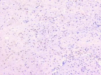 IHC staining of FFPE rat brain with TNFRSF11B antibody. HIER: boil tissue sections in pH6, 10mM citrate buffer, for 20 min and allow to cool before testing.