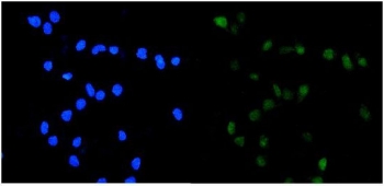 TOP2A Antibody U-2 OS Cell IF. Immunofluorescent staining of FFPE human U-2 OS cells using TOP2A Antibody for IF / Topoisomerase II Alpha Immunofluorescence Antibody. Heat-induced epitope retrieval was performed using pH6 citrate buffer prior to staining. TOP2A immunoreactivity (green) is predominantly localized to the nuclei, while DAPI (blue) counterstains cell nuclei. The staining pattern is consistent with the expected nuclear localization of Topoisomerase II alpha in proliferating cells. This TOP2A Antibody for IF is suitable for studies of nuclear protein localization, DNA replication, chromosome segregation, and cell cycle regulation.