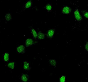 TOP2A Antibody U-2 OS Nuclear IF. Immunofluorescent staining of fixed and permeabilized human U-2 OS cells using TOP2A Antibody for IF / Topoisomerase II Alpha Immunofluorescence Antibody at 5 ug/ml. Cells underwent enzyme-mediated antigen retrieval for 15 minutes, followed by detection with a Fluoro488-conjugated goat anti-rabbit IgG secondary antibody (green). TOP2A staining is predominantly localized to the nuclei, consistent with the expected distribution of this DNA topoisomerase in proliferating cells. This TOP2A Antibody for IF is suitable for studies of nuclear protein localization, DNA replication, chromosome segregation, and cell cycle regulation.