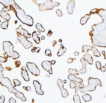 IHC staining of FFPE human placenta with MTR antibody. HIER: boil tissue sections in pH6, 10mM citrate buffer, for 20 min and allow to cool before testing.