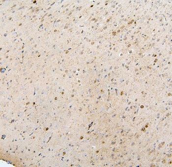 IHC staining of FFPE mouse brain with MTR antibody. HIER: boil tissue sections in pH6, 10mM citrate buffer, for 20 min and allow to cool before testing.